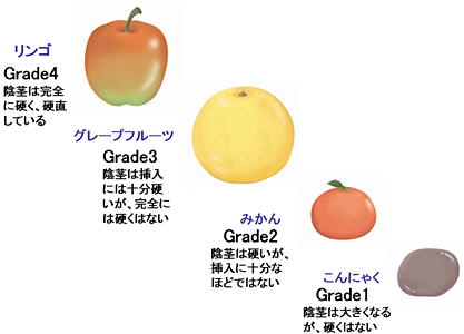EDのグレード